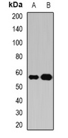 Anti-Atase Antibody