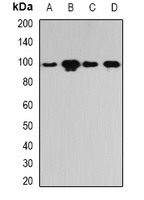 Anti-PYGL Antibody