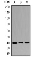 Anti-MRNP41 Antibody