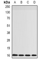 Anti-RPS14 Antibody