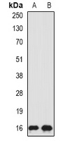 Anti-SRP19 Antibody