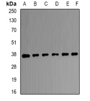 Anti-Transaldolase Antibody