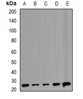 Anti-TMP21 Antibody
