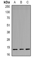 Anti-TPPP3 Antibody