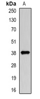Anti-DCAF7 Antibody