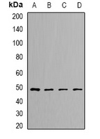 Anti-DLST Antibody