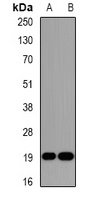 Anti-DR1 Antibody
