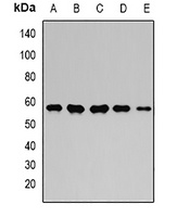 Anti-GPI Antibody