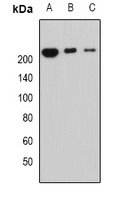 Anti-Periplakin Antibody