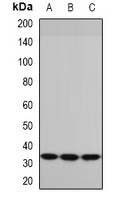 Anti-P5CR Antibody