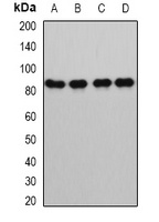 Anti-GlnRS Antibody