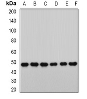 Anti-RbAp46 Antibody