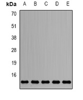 SNRPD2 antibody