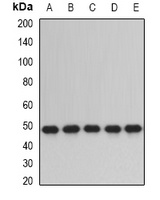Anti-ERp5 Antibody