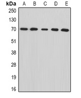 Anti-tNOX Antibody