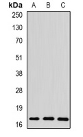 THRSP antibody