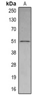 Anti-SETD6 Antibody