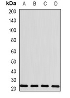 Anti-BLVRB Antibody