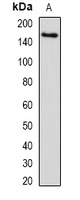 Anti-SETD5 Antibody