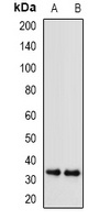 Anti-SGTA Antibody