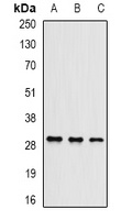 UBE2J2 antibody