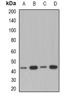 Anti-ACAA1 Antibody