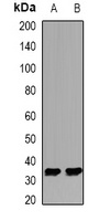 KHK antibody