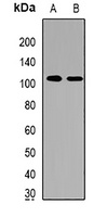 Anti-HRP2 Antibody