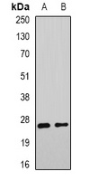 Anti-DNAJB9 Antibody