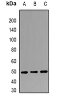 Anti-LSm11 Antibody