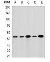 Anti-GLUD1 Antibody