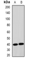 UBIAD1 antibody