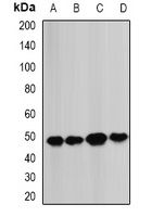 Anti-BCS1L Antibody