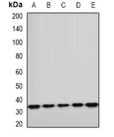 ETFA antibody