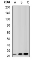 Anti-GSTA2 Antibody