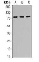 Anti-HSPA6 Antibody