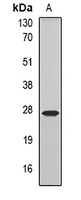 Anti-COQ7 Antibody