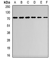 Anti-AspRS Antibody