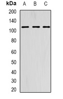 Anti-AARS2 Antibody