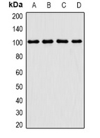 TGS1 antibody