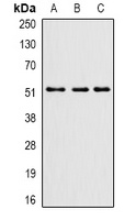 Anti-PHF21B Antibody