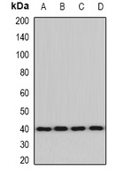 Anti-ACAT2 Antibody