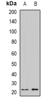 CRYGS antibody