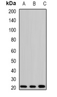 Anti-H-Ras Antibody