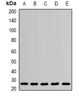 Anti-PSPH Antibody
