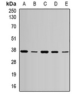 AURKC antibody