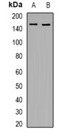 KDM4A antibody