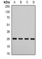 Anti-Metaxin-2 Antibody