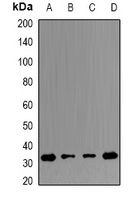 Anti-ERP29 Antibody