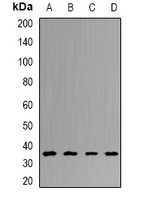 UCHL5 antibody